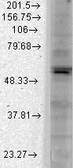 Anti-Kir2.1 antibody [S112B-14] used in Western Blot (WB). GTX41991