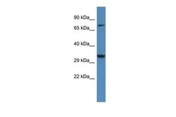 Anti-Stargazin antibody, Internal used in Western Blot (WB). GTX44632