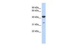 Anti-HCG_1745121 antibody, N-term used in Western Blot (WB). GTX44832