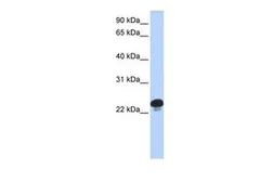 Anti-CAPS antibody, N-term used in Western Blot (WB). GTX44853