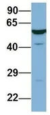 Anti-LAP3 antibody, N-term used in Western Blot (WB). GTX45029