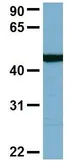 Anti-C22ORF28 antibody, N-term used in Western Blot (WB). GTX45035
