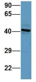 Anti-SERPINE2 antibody, Internal used in Western Blot (WB). GTX45043