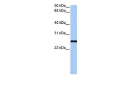 Anti-CCDC46 antibody, C-term used in Western Blot (WB). GTX45452