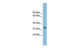 Anti-NXPH4 antibody, N-term used in Western Blot (WB). GTX45503