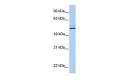 Anti-NHEDC2 antibody, C-term used in Western Blot (WB). GTX45540