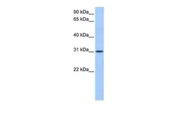 Anti-HUS1B antibody, N-term used in Western Blot (WB). GTX45681