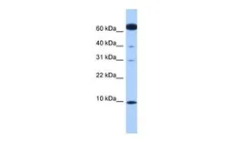 Anti-DYNLL2 antibody, N-term used in Western Blot (WB). GTX45766