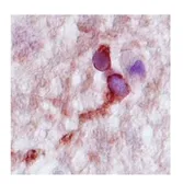 Anti-CPLX2 antibody, N-term used in IHC (Paraffin sections) (IHC-P). GTX45797