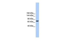 Anti-TMC2 antibody, Internal used in Western Blot (WB). GTX45881