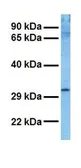 Anti-NMNAT1 antibody, N-term used in Western Blot (WB). GTX46173