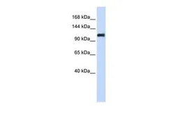 Anti-Nidogen 2 antibody, Internal used in Western Blot (WB). GTX46198