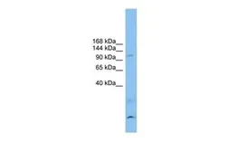 Anti-Calsyntenin3 antibody, N-term used in Western Blot (WB). GTX46369