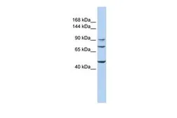 Anti-GALNT5 antibody, Internal used in Western Blot (WB). GTX46374