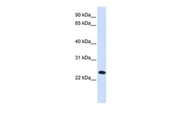 Anti-C20ORF103 antibody, Internal used in Western Blot (WB). GTX46392