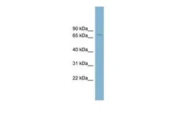 Anti-LRRN2 antibody, Internal used in Western Blot (WB). GTX46415