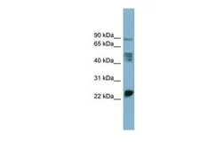 Anti-MPZL1 antibody, Internal (GTX46451) | GeneTex