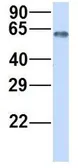 Anti-SLCO3A1 antibody, Internal used in Western Blot (WB). GTX46819