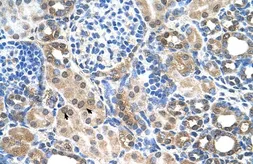 Anti-SLC22A7 antibody, C-term used in IHC (Paraffin sections) (IHC-P). GTX46968