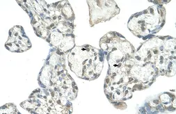 Anti-EPS8L1 antibody, N-term used in IHC (Paraffin sections) (IHC-P). GTX47009