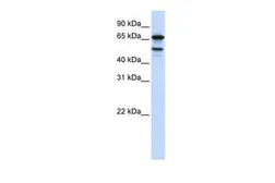 Anti-SF4 antibody, Internal used in Western Blot (WB). GTX47197