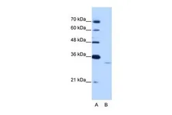 Anti-EXOSC6 antibody, N-term used in Western Blot (WB). GTX47230