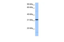 Anti-FUSIP1 antibody, C-term used in Western Blot (WB). GTX47231