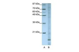 Anti-Apolipoprotein O antibody, N-term used in Western Blot (WB). GTX47255