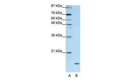 Anti-Apolipoprotein O antibody, C-term used in Western Blot (WB). GTX47256