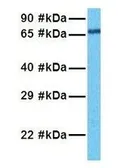 Anti-LARP7 antibody, C-term used in Western Blot (WB). GTX47301