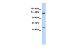 Anti-SF3B1 antibody, N-term used in Western Blot (WB). GTX47328