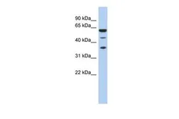 Anti-NELF-E antibody, N-term used in Western Blot (WB). GTX47390