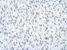 Anti-SF3B1 antibody, Internal used in IHC (Paraffin sections) (IHC-P). GTX47418