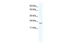 Anti-KCTD6 antibody, N-term used in Western Blot (WB). GTX47442