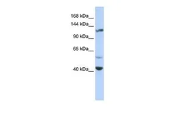 Anti-KCNH3 antibody, Internal used in Western Blot (WB). GTX47445