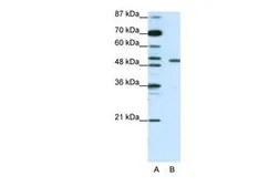 Anti-KCNAB2 antibody, Internal used in Western Blot (WB). GTX47448