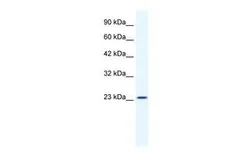 Anti-KCTD11 antibody, N-term used in Western Blot (WB). GTX47451