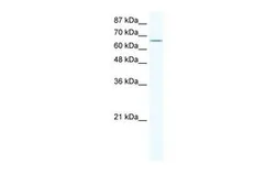 Anti-Cav beta 2 antibody, N-term used in Western Blot (WB). GTX47458