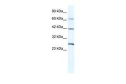 Anti-GJC1 antibody, N-term used in Western Blot (WB). GTX47480