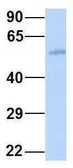 Anti-GJA9 antibody, Internal used in Western Blot (WB). GTX47481