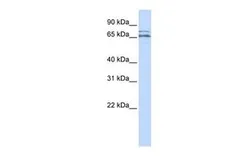 Anti-Cav beta 2 antibody, Internal used in Western Blot (WB). GTX47538