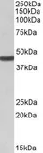 Anti-KCNJ1 / ROMK antibody, Internal used in Western Blot (WB). GTX47558