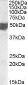 Anti-CLMP antibody, C-term used in Western Blot (WB). GTX47579
