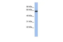 Anti-Cav beta 2 antibody, Internal used in Western Blot (WB). GTX47609