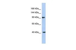 Anti-KCNH6 antibody, Internal used in Western Blot (WB). GTX47621