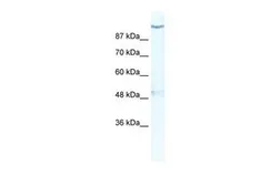 Anti-KCNH6 antibody, Internal used in Western Blot (WB). GTX47622