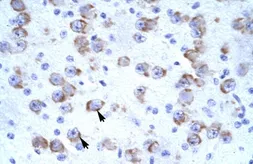 Anti-CATSPER2 antibody, N-term used in IHC (Paraffin sections) (IHC-P). GTX47630