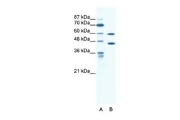 Anti-CATSPER2 antibody, C-term used in Western Blot (WB). GTX47632