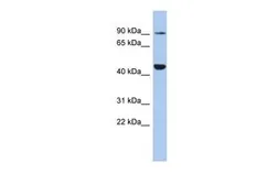 Anti-Kv11.1 antibody, Internal used in Western Blot (WB). GTX47633