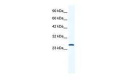 Anti-Cav gamma 6 antibody, N-term used in Western Blot (WB). GTX47638